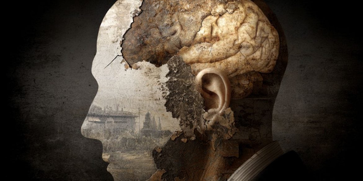 This shows a head and a brain.