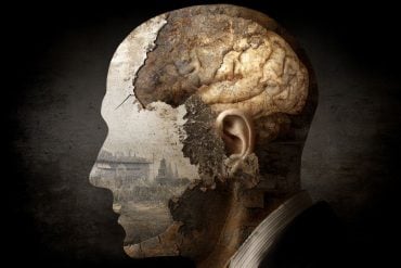 This shows a head and a brain.