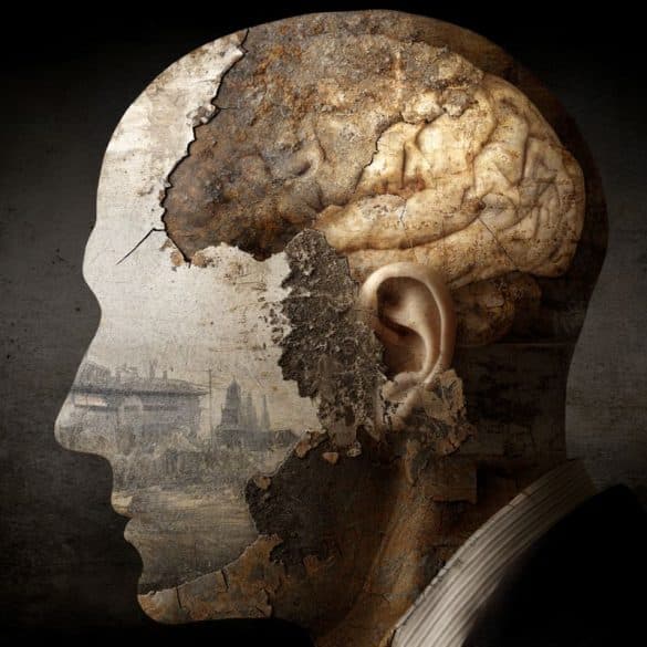 This shows a head and a brain.