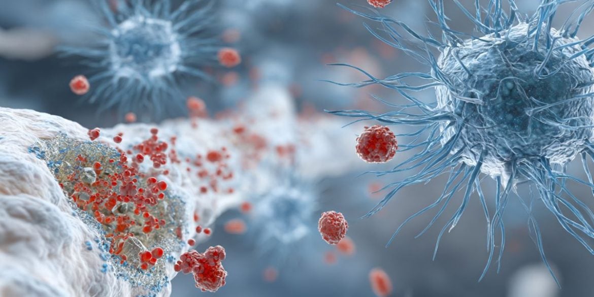 Tiny Gut Imposters Could Be Driving Multiple Sclerosis