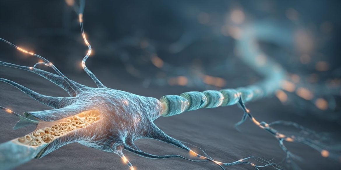 This shows a neuron with a broken myelin sheath.