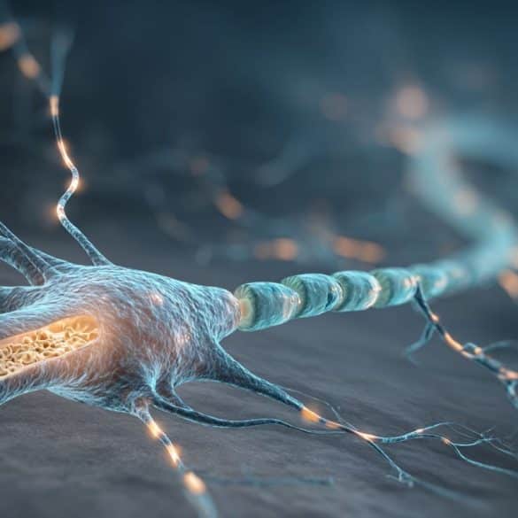 This shows a neuron with a broken myelin sheath.