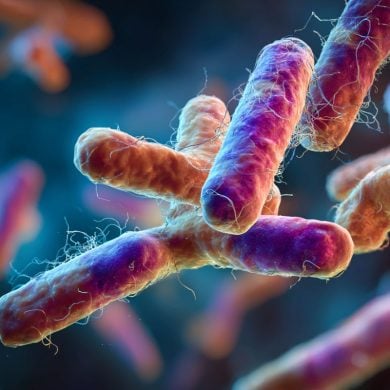 This shows bacteria.