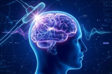 A scientific illustration showing a Transcranial Magnetic Stimulation (TMS) coil placed against a human head, delivering a magnetic pulse to a glowing blue brain. Background elements include data points and EEG wave lines, representing the measurement of brain complexity in Alzheimer's research.