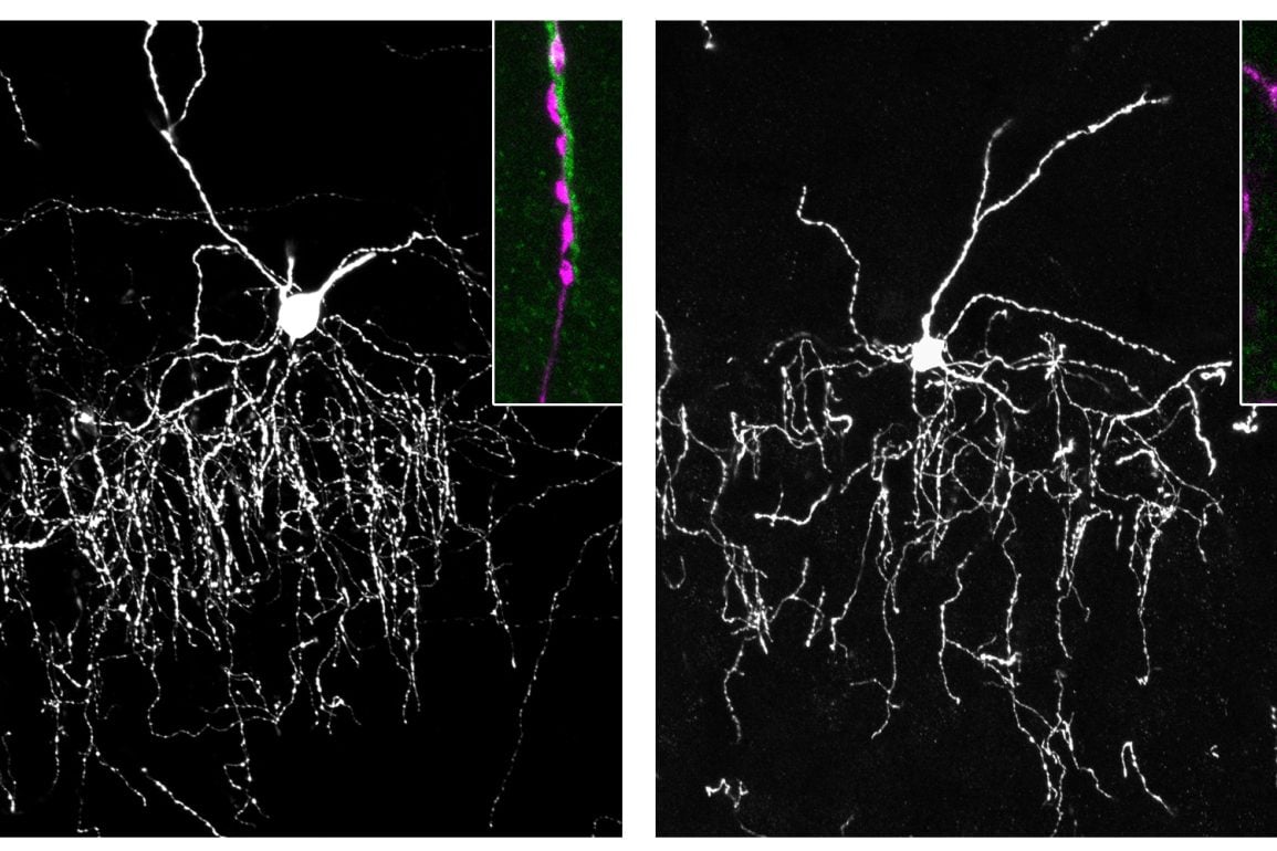 Illustration of chandelier cells connecting to pyramidal neurons in the brain.