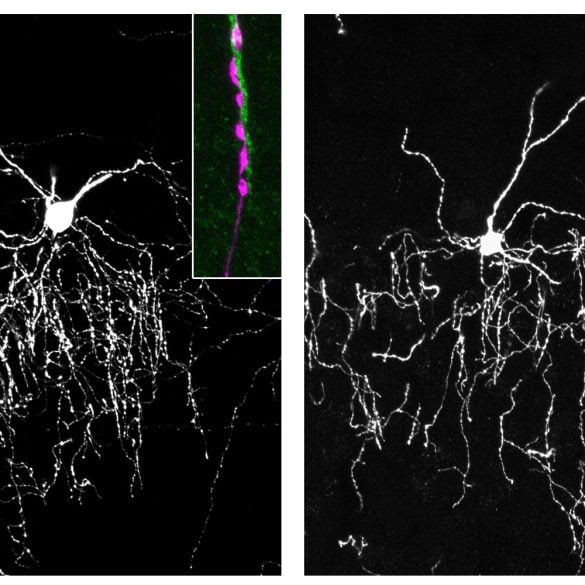 Illustration of chandelier cells connecting to pyramidal neurons in the brain.