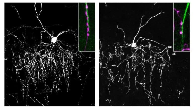 Illustration of chandelier cells connecting to pyramidal neurons in the brain.