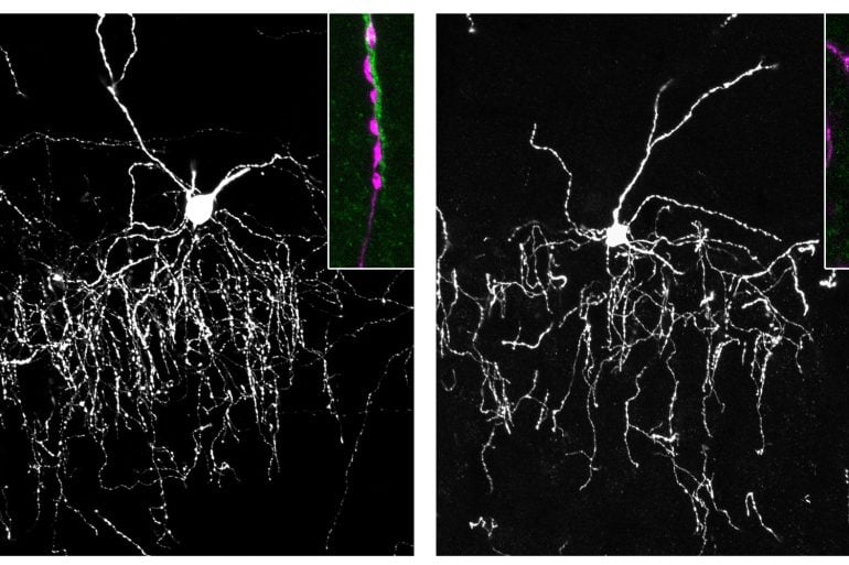 Illustration of chandelier cells connecting to pyramidal neurons in the brain.