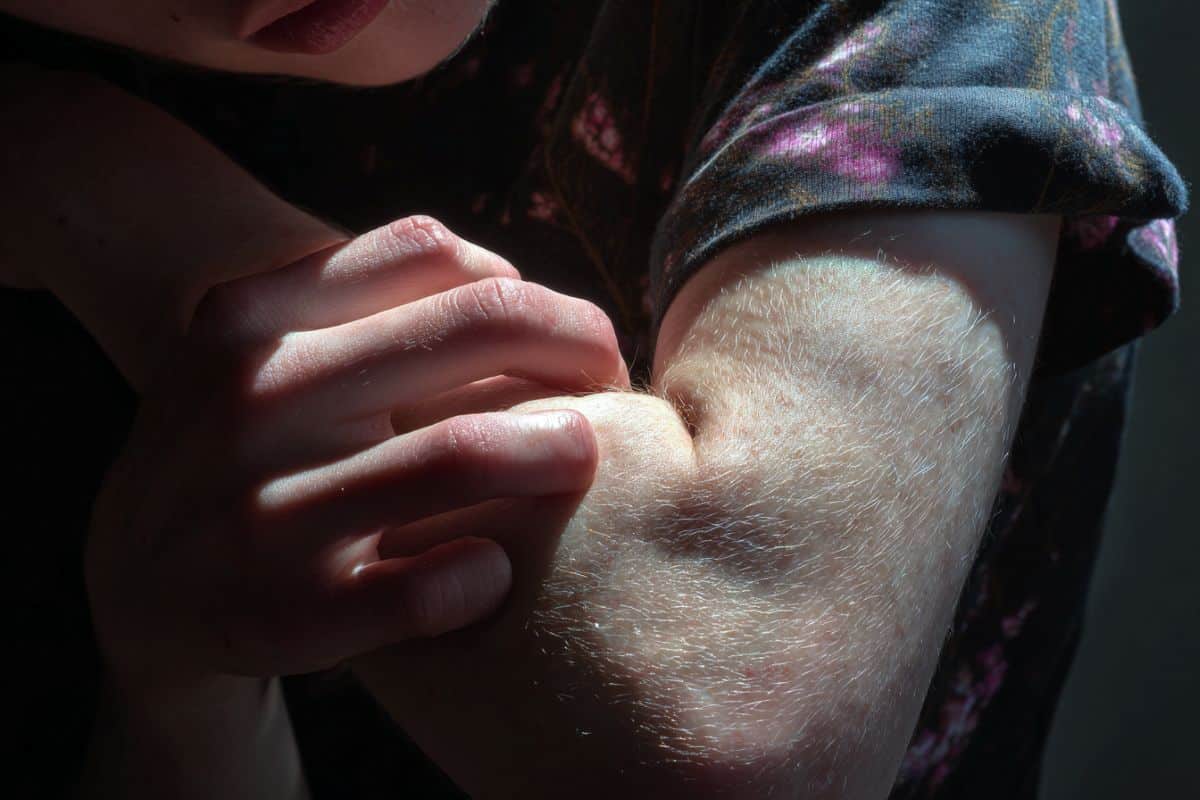 This shows a person scratching their arm.