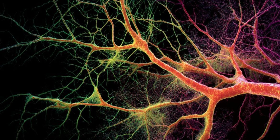 This shows neurons branching.