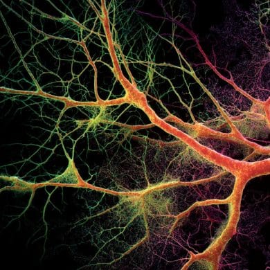 This shows neurons branching.