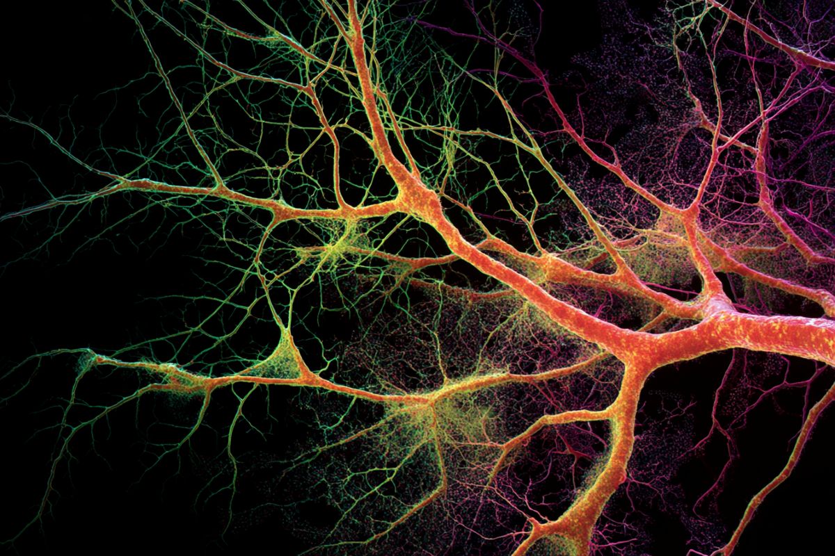 This shows neurons branching.