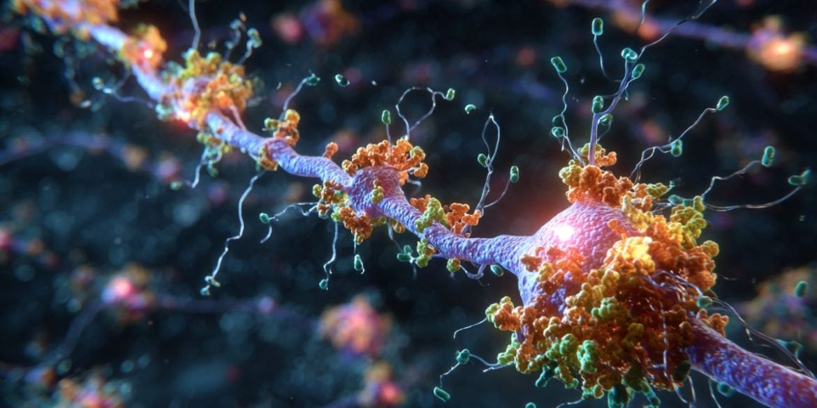 This shows a representation of a hippocampal neuron.