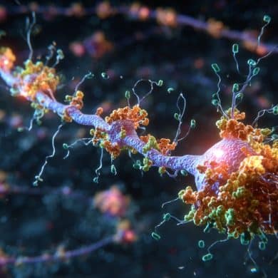 This shows a representation of a hippocampal neuron.