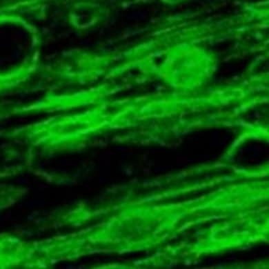 This shows a microscopy image of myelin swelling in a brain sample.