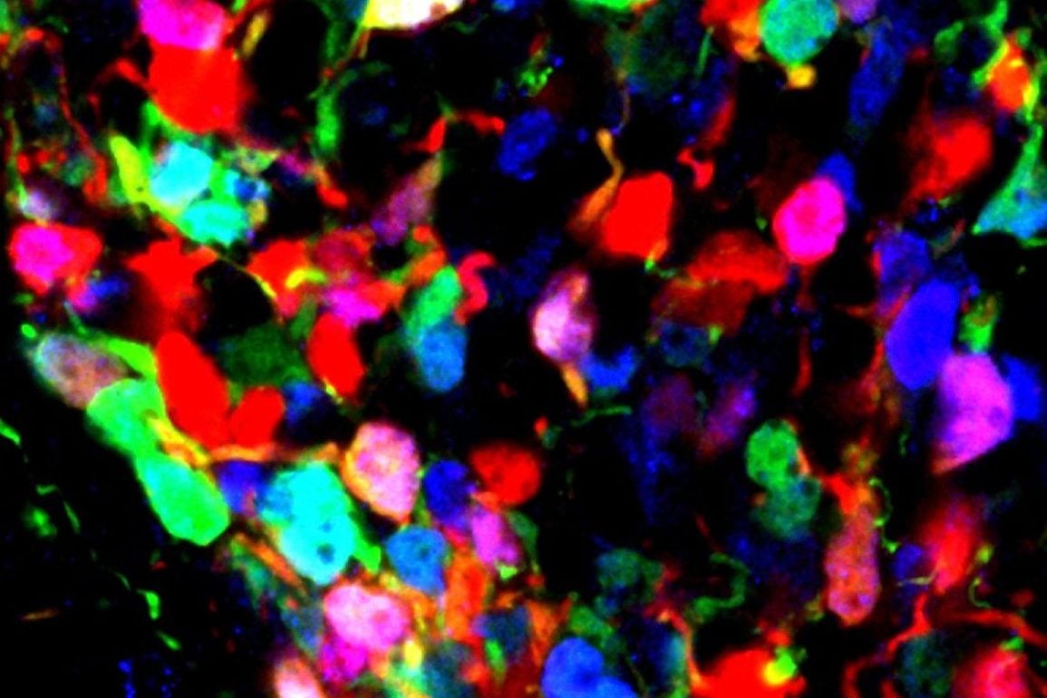 Brain’s Developmental Switch May Shape Lifelong Obesity Risk Brain’s Developmental Switch May Shape Lifelong Obesity Risk