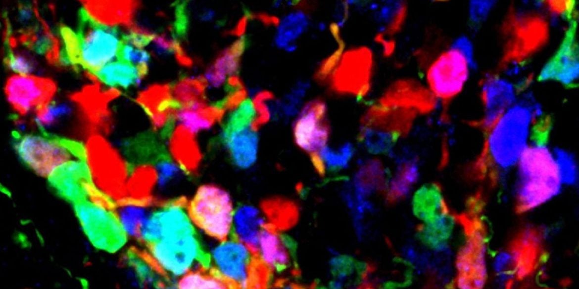 This shows hypothalamic cells.