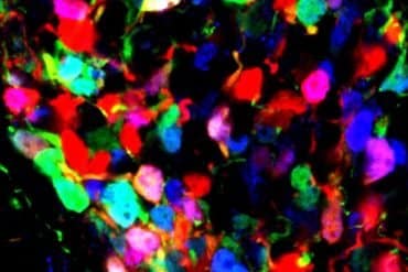 This shows hypothalamic cells.