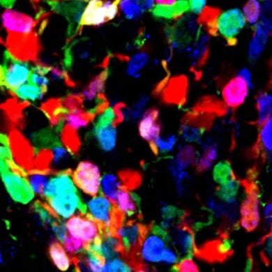 This shows hypothalamic cells.