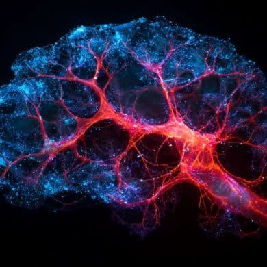 This shows metabolic pathways in the brain.