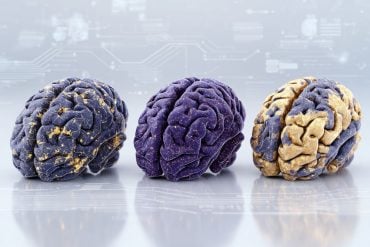 This shows three brains.