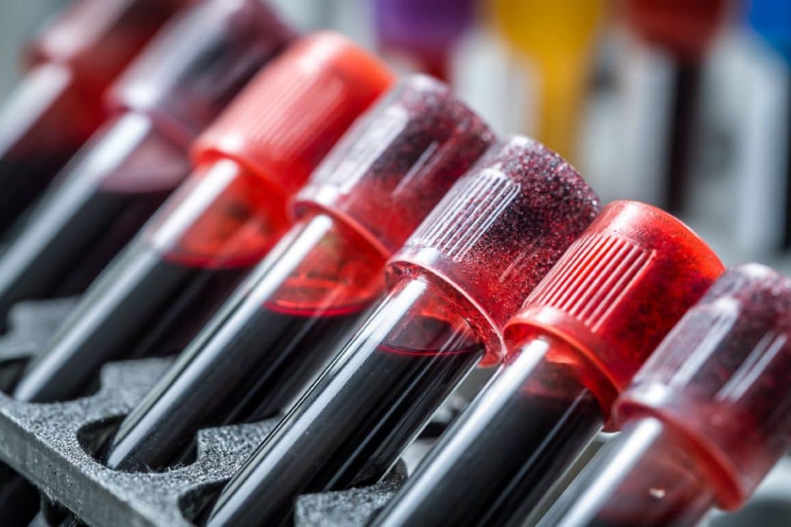 This shows blood vials.