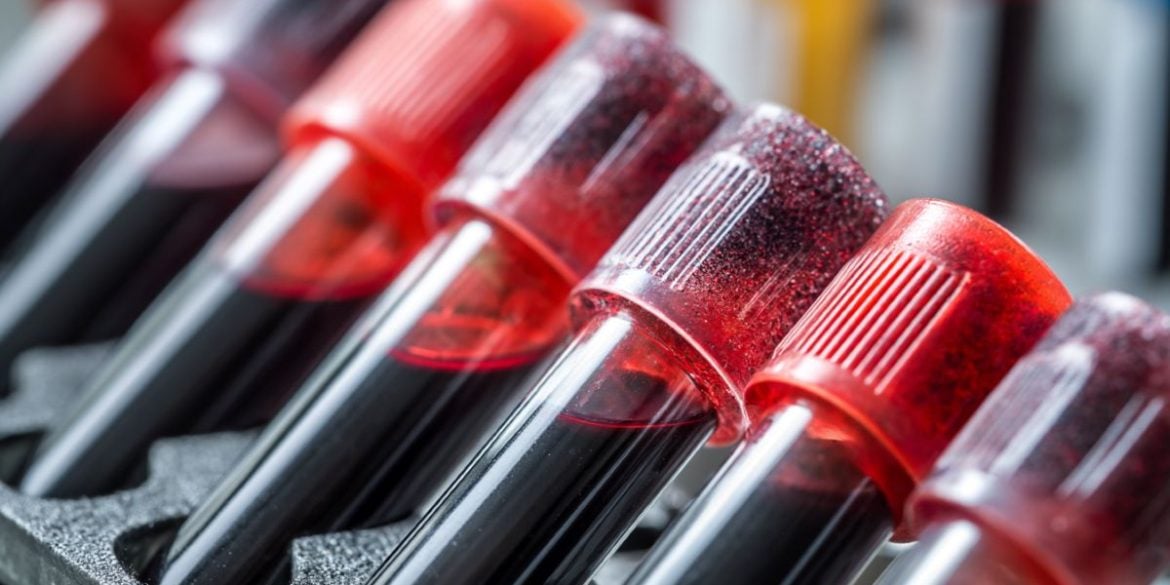 This shows blood vials.