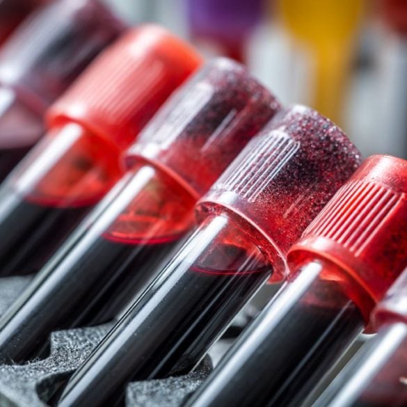 This shows blood vials.