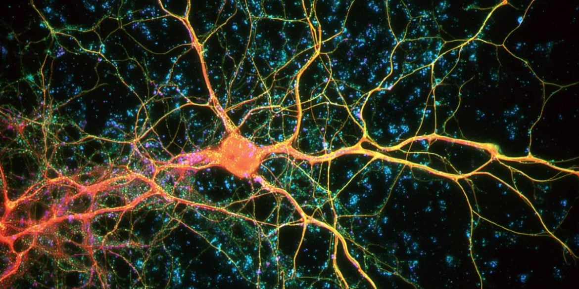This shows neurons.