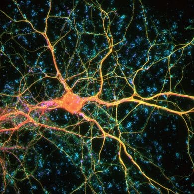 This shows neurons.