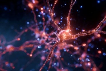 This shows a blood vessel in the brain.