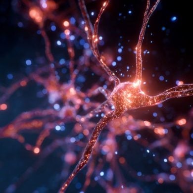 This shows a blood vessel in the brain.