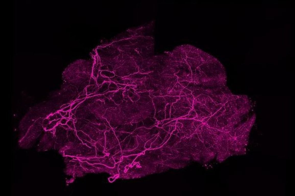 Split Protein Builds the Infrastructure for Weight Loss