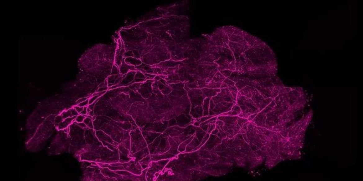 This shows brown fat under the microscope.
