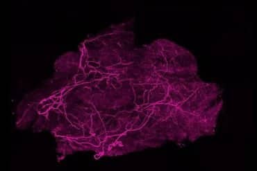 This shows brown fat under the microscope.