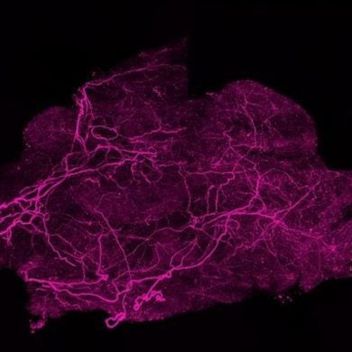 This shows brown fat under the microscope.