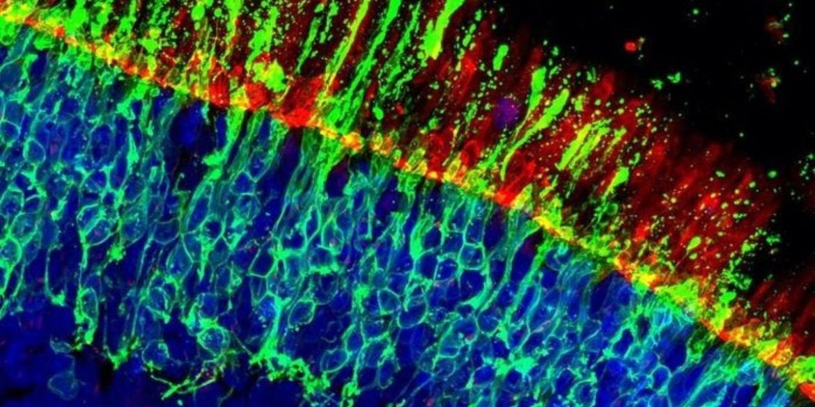 This shows human retinal cells.