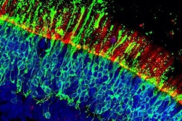 This shows human retinal cells.