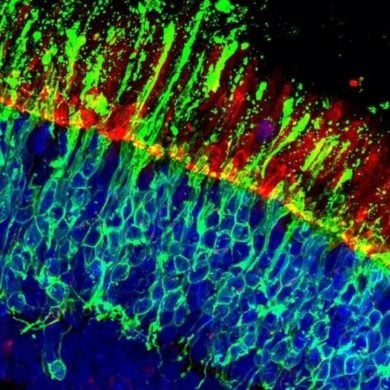 This shows human retinal cells.