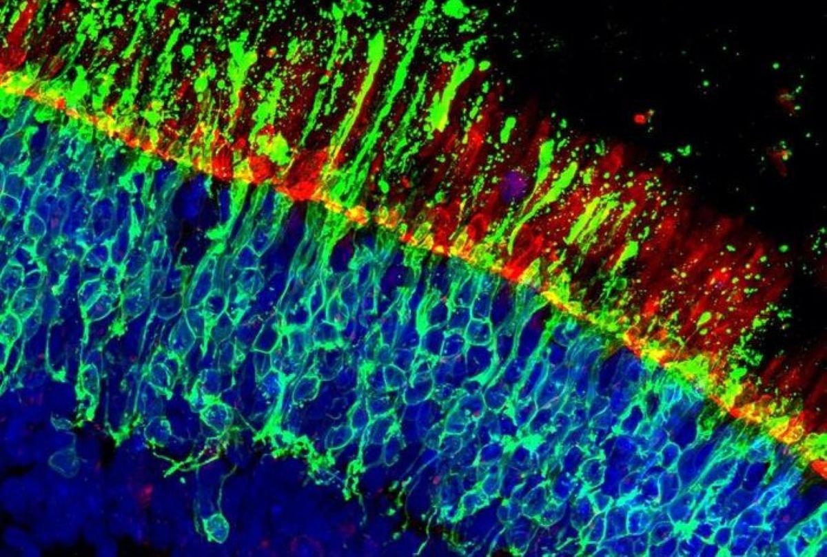 This shows human retinal cells.