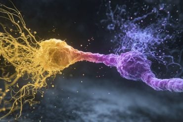 This shows a neuron.