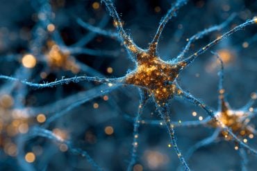 This shows astrocytes.