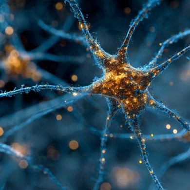 This shows astrocytes.