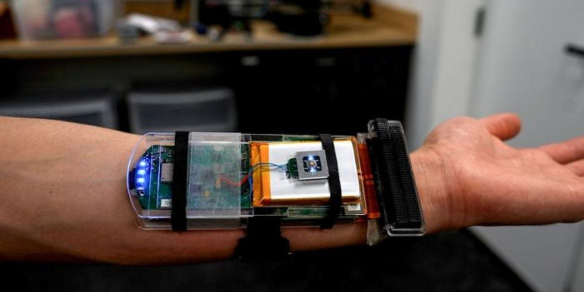 This shows the arm device.