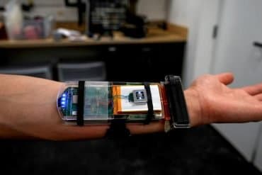 This shows the arm device.