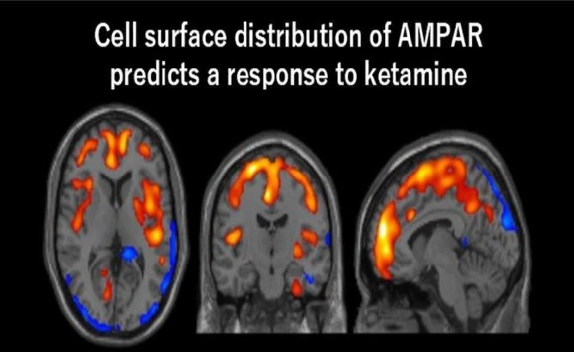 This shows PET scan images of the brain in response to ketamine.