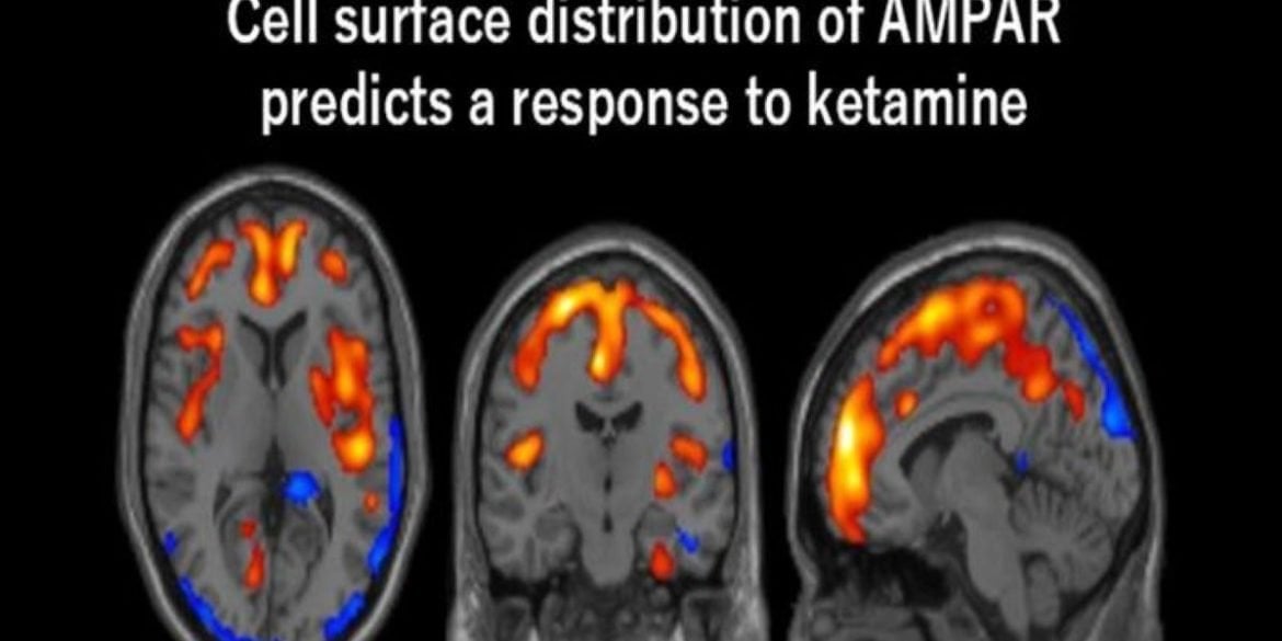 This shows PET scan images of the brain in response to ketamine.