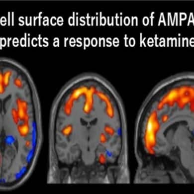 This shows PET scan images of the brain in response to ketamine.