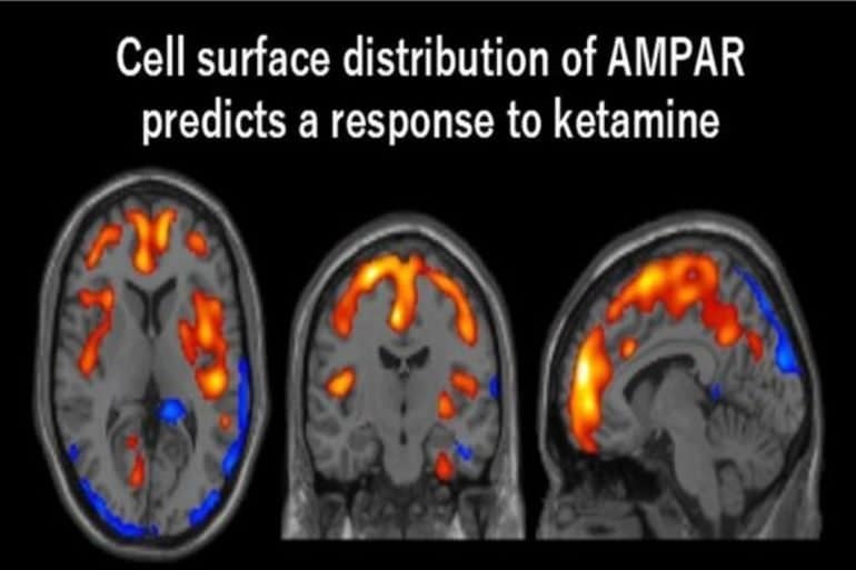 This shows PET scan images of the brain in response to ketamine.