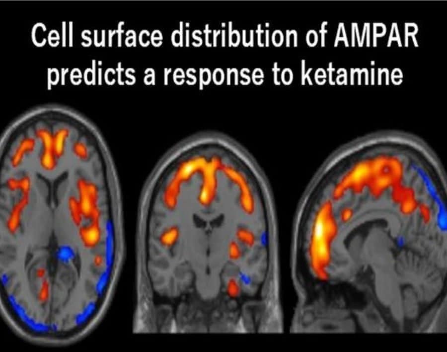 This shows PET scan images of the brain in response to ketamine.